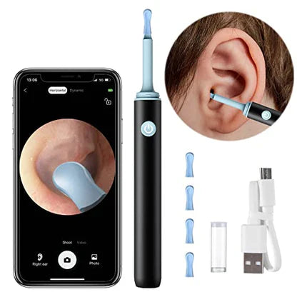 NYXARA™  - PROFESSIONAL EAR WAX REMOVAL TOOL